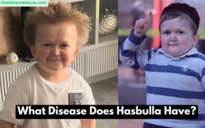 What Disease Does Hasbulla Have