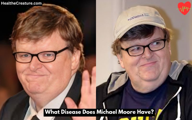 What Disease Does Michael Moore Have