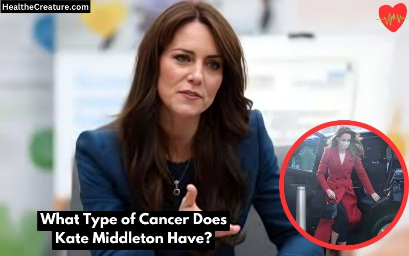 What Type of Cancer Does Kate Middleton Have?